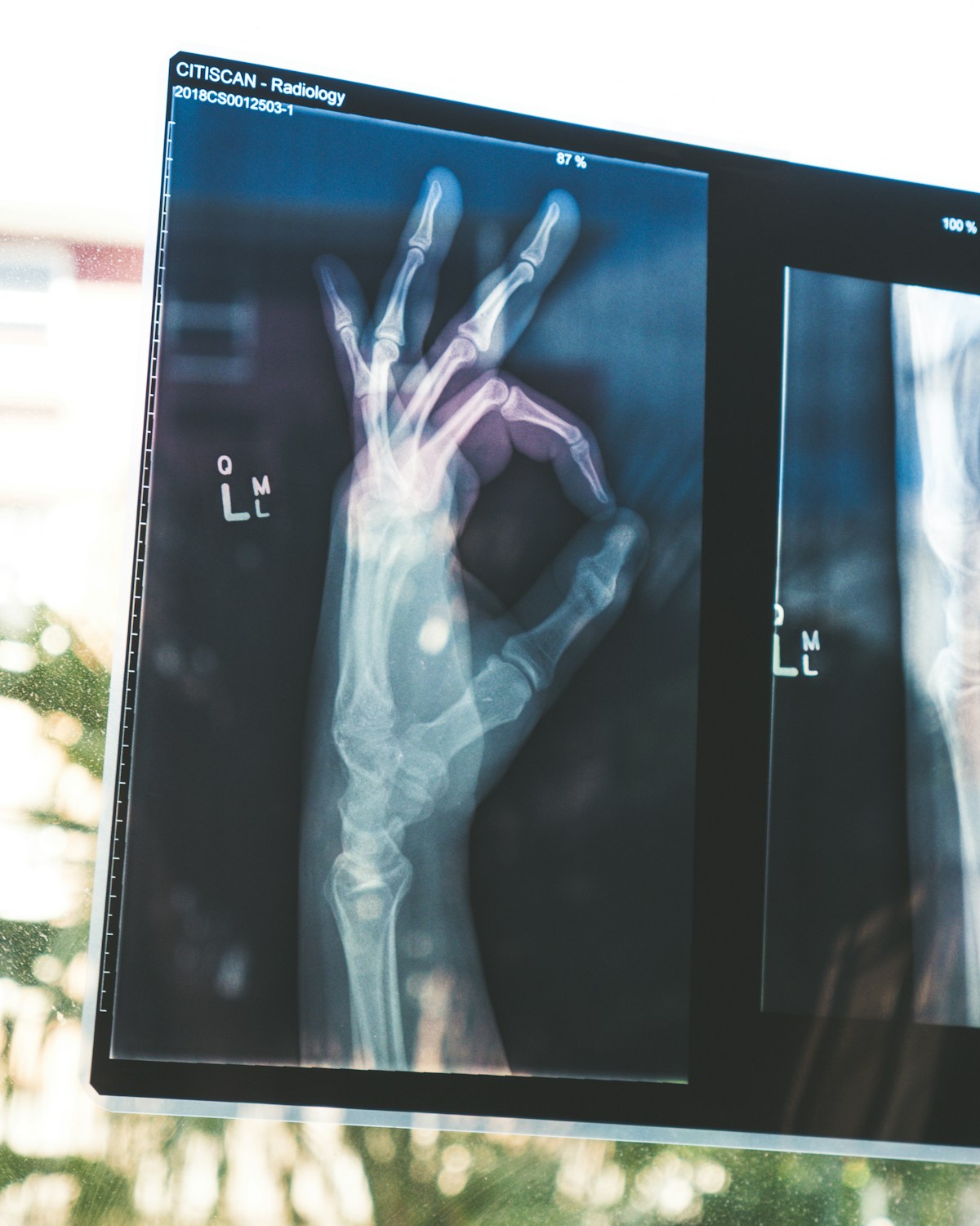 Digital X-ray equipment in the Marion Open MRI imaging room